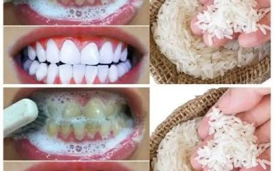 SBIANCAMENTO RAPIDO DEI DENTI in 1 Minuto! 😁✨