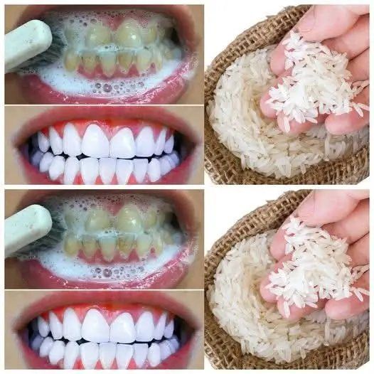 SBIANCAMENTO RAPIDO DEI DENTI in 1 Minuto! 😁✨