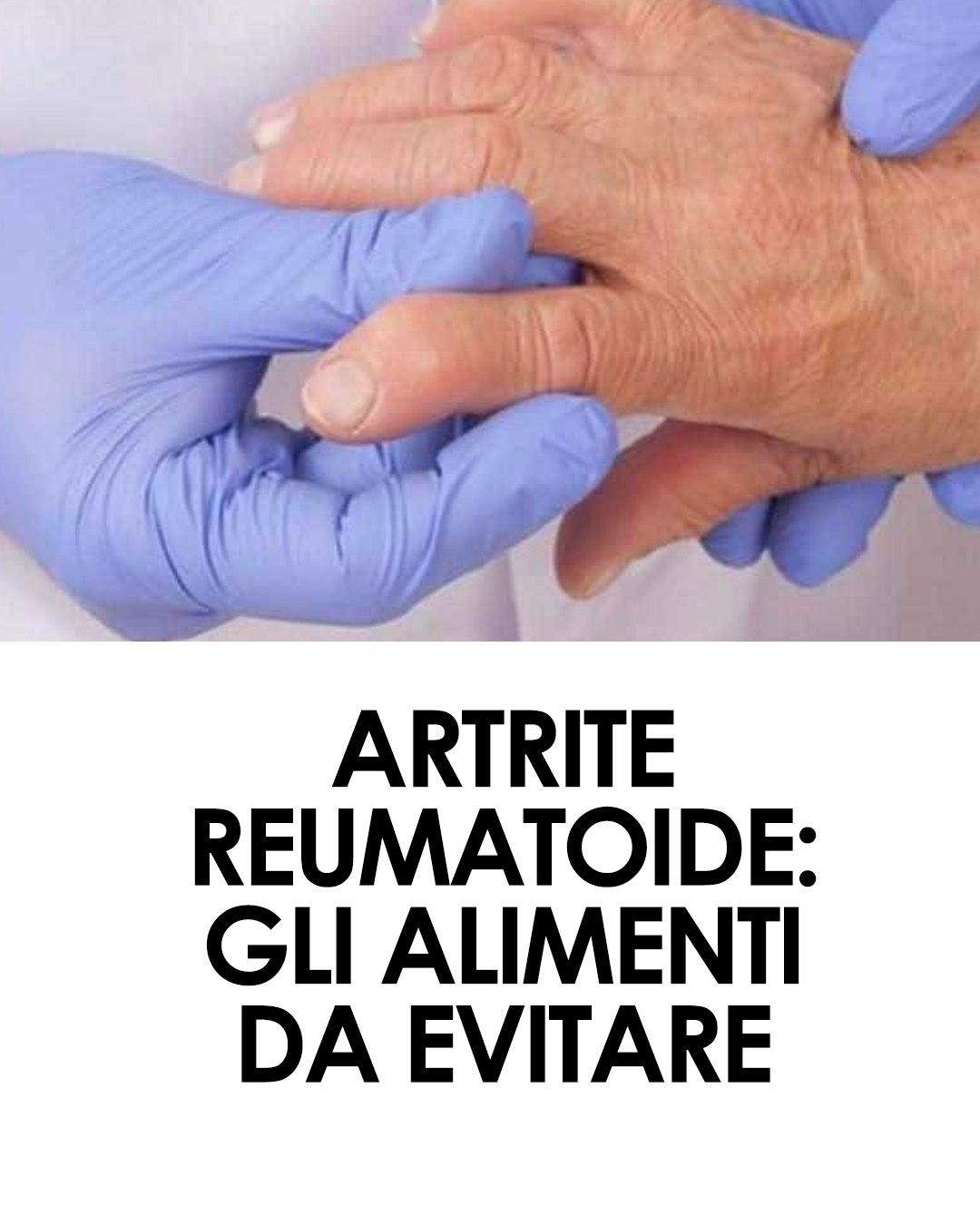 Come si vive con l’artrite reumatoide? Le difficoltà che si devono affrontare