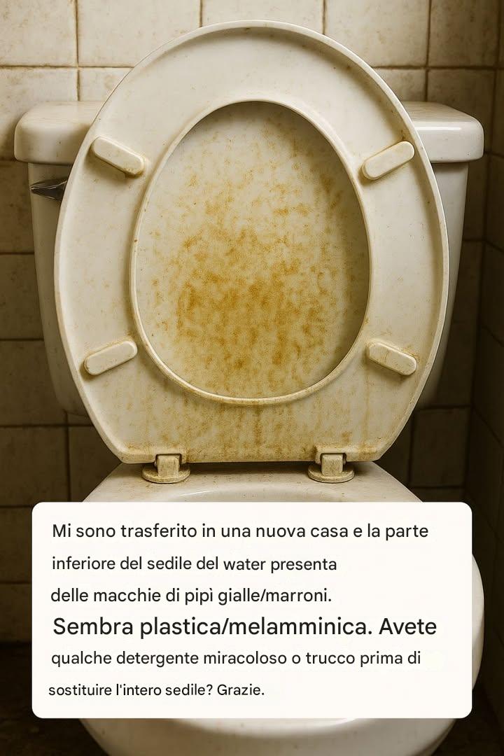 Sedile del WC con macchie giallo-marroni: perché si formano e come elimina