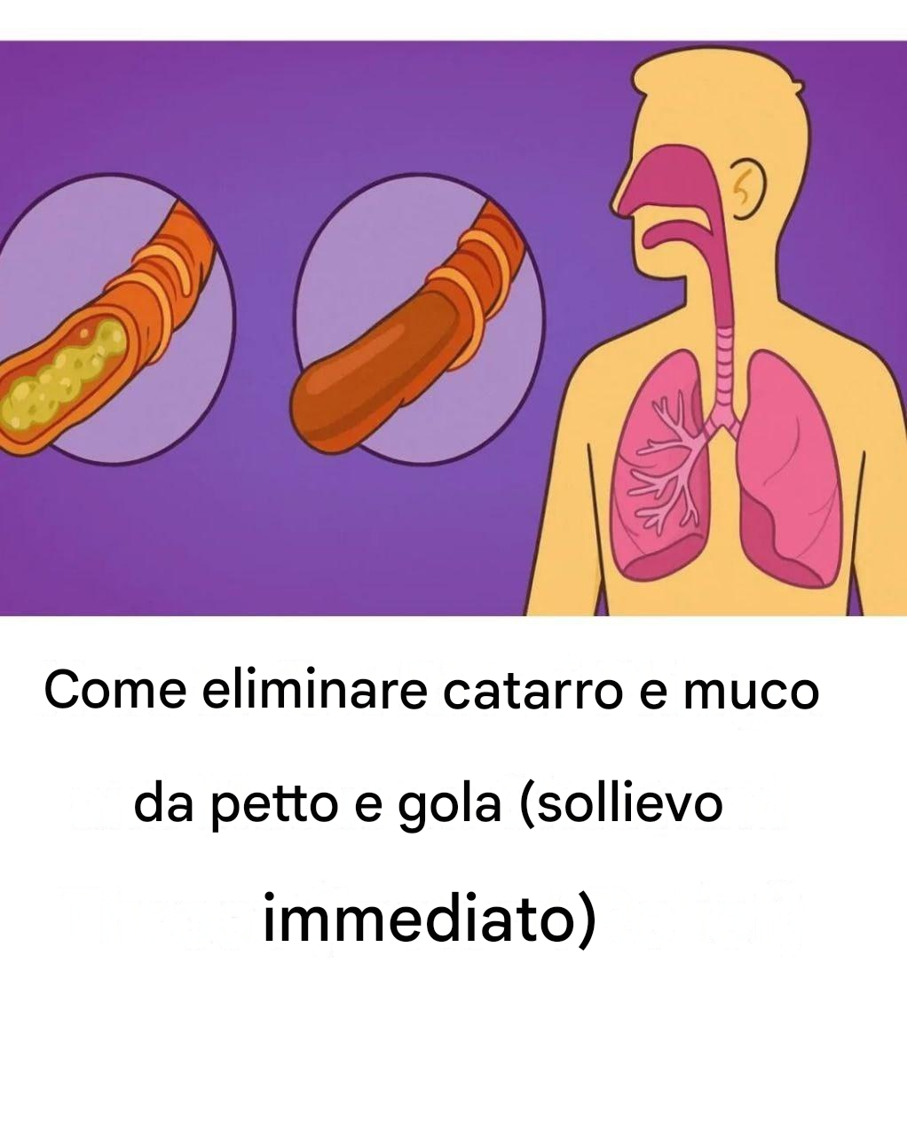 Cosa può davvero aiutare a fluidificare il muco