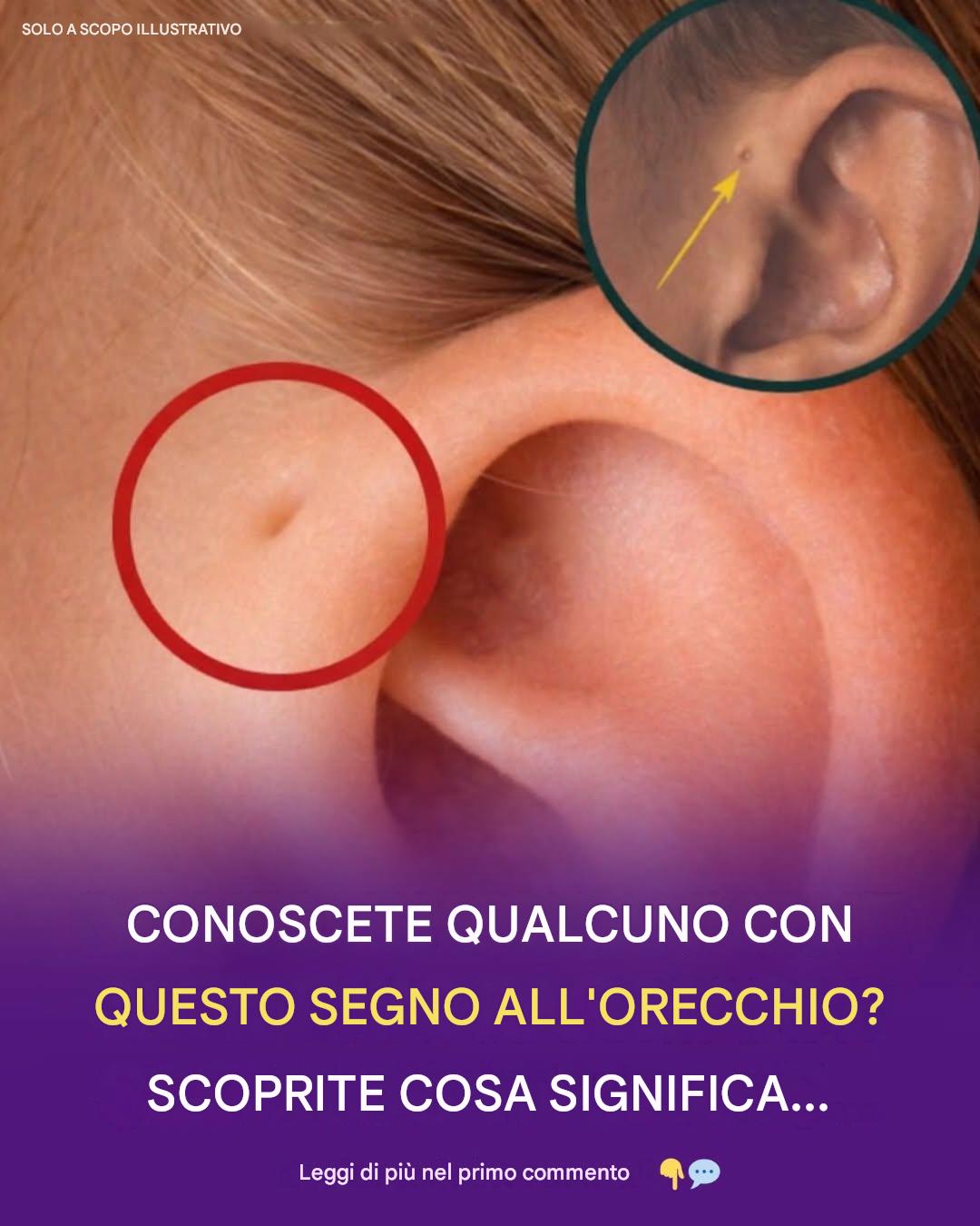 Il piccolo foro vicino all’orecchio: un indizio del nostro passato evolutivo?