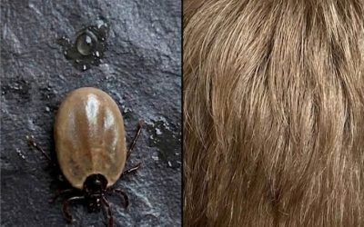 Come mantenere la calma quando scopri degli “ospiti indesiderati” tra i capelli di tuo figlio