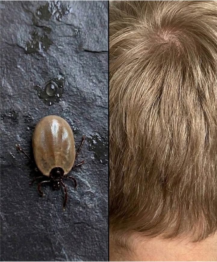 Come mantenere la calma quando scopri degli “ospiti indesiderati” tra i capelli di tuo figlio