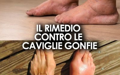 Rimedi naturali contro le caviglie gonfie: cause, soluzioni e consigli utili