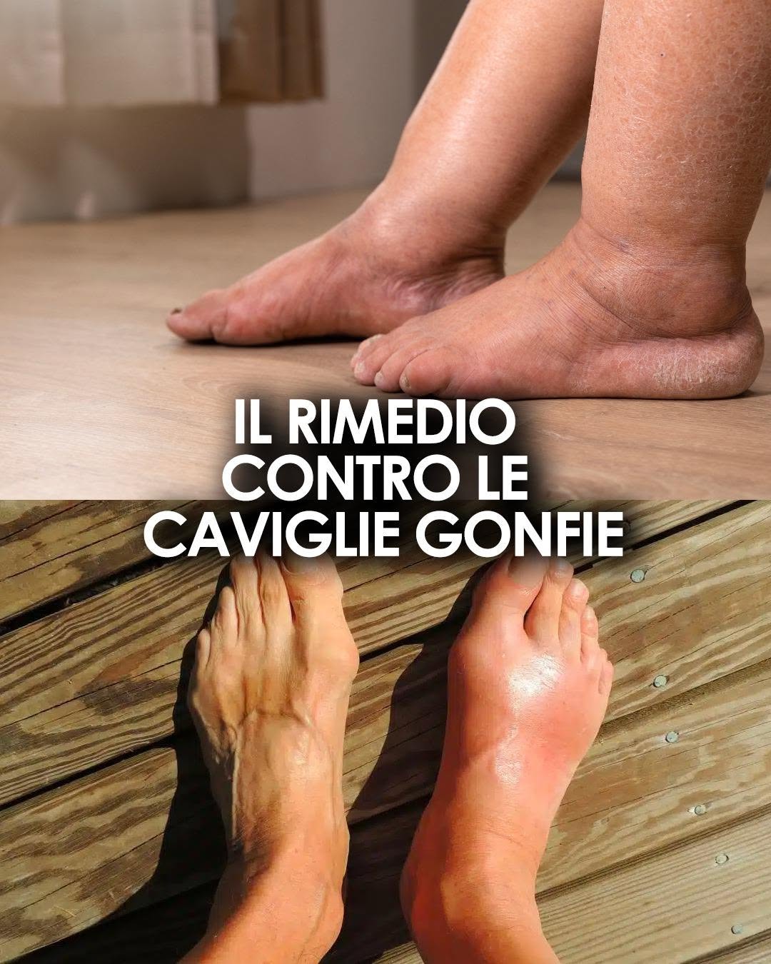 Rimedi naturali contro le caviglie gonfie: cause, soluzioni e consigli utili