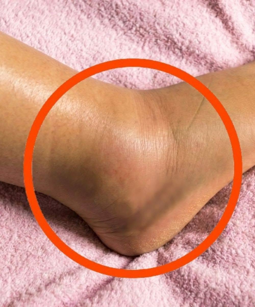 Gambe gonfie: cosa potrebbe significare? Cause comuni da non ignorare mai